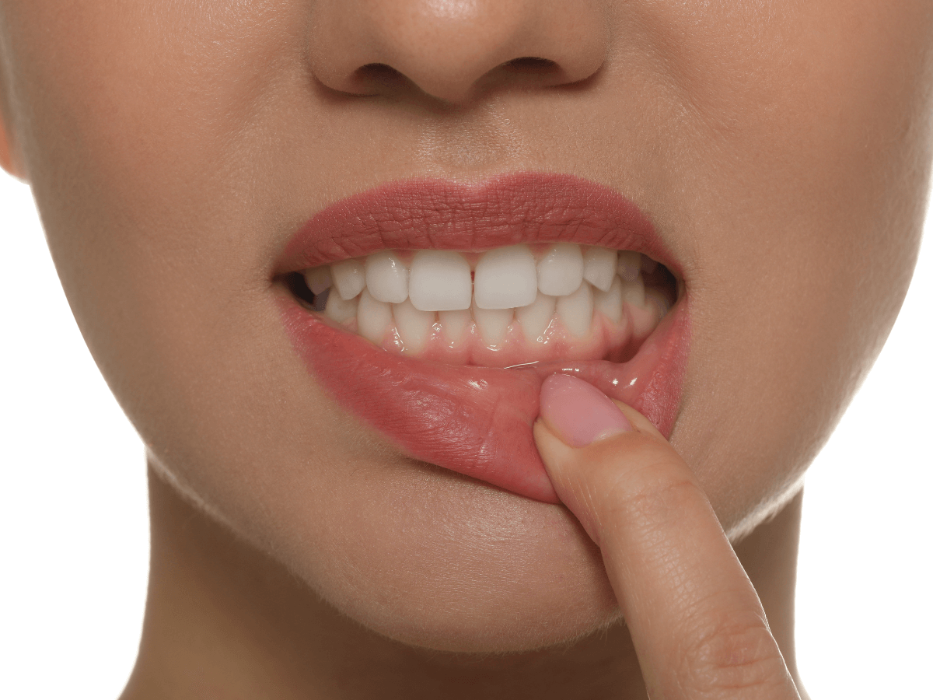 dental implants centennial | woman with gum disease