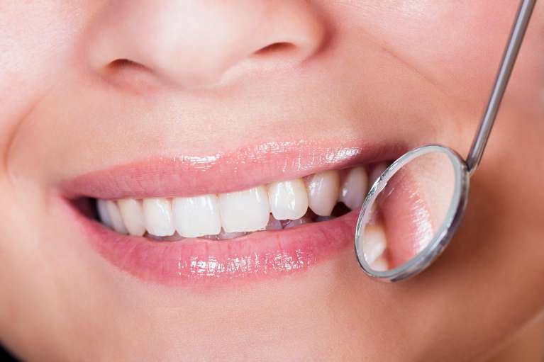 woman at the dentist in centennial co